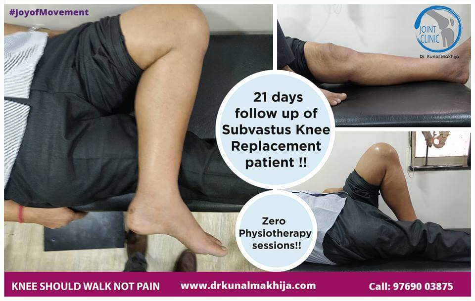 subvastus knee replacement panvel, navi mumbai