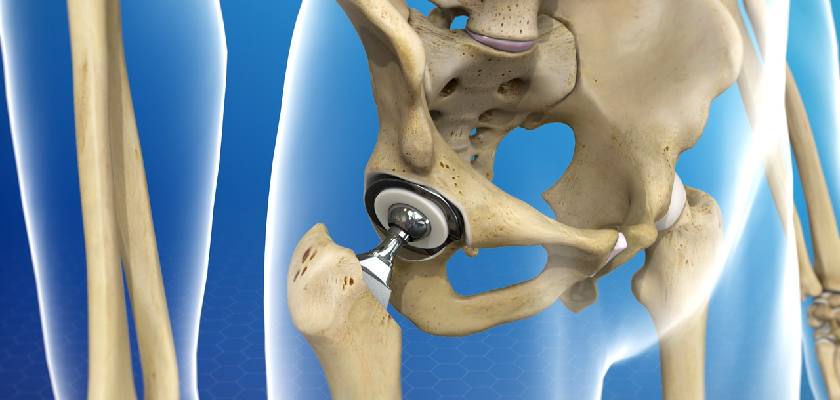 hip joint replacement surgery in panvel, navi mumbai