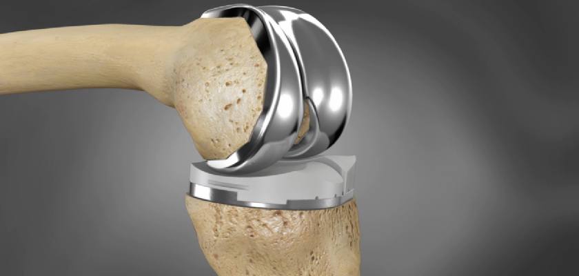 knee joint replacement surgery in panvel, navi mumbai