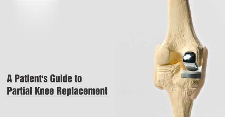 knee joint replacement surgery in panvel, navi mumbai